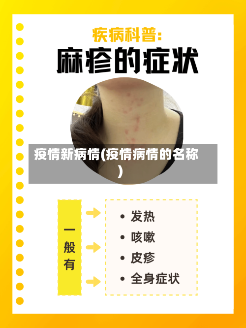 疫情新病情(疫情病情的名称)